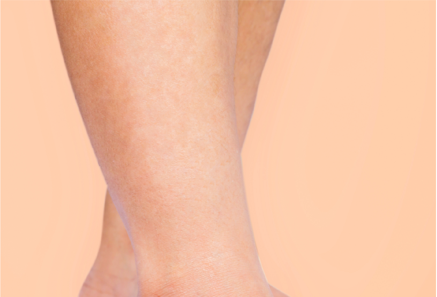 Résultats visibles d'une épilation définitive sur les jambes après plusieurs séances avec les appareils LSWS. Peau nette et sans poils